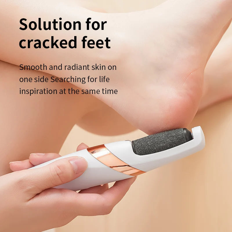 Electric Foot Callus Remover – Rechargeable Pedicure Tool